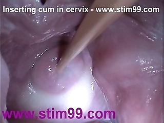 Interpolate ball batter cum in cervix here distention pussy speculum